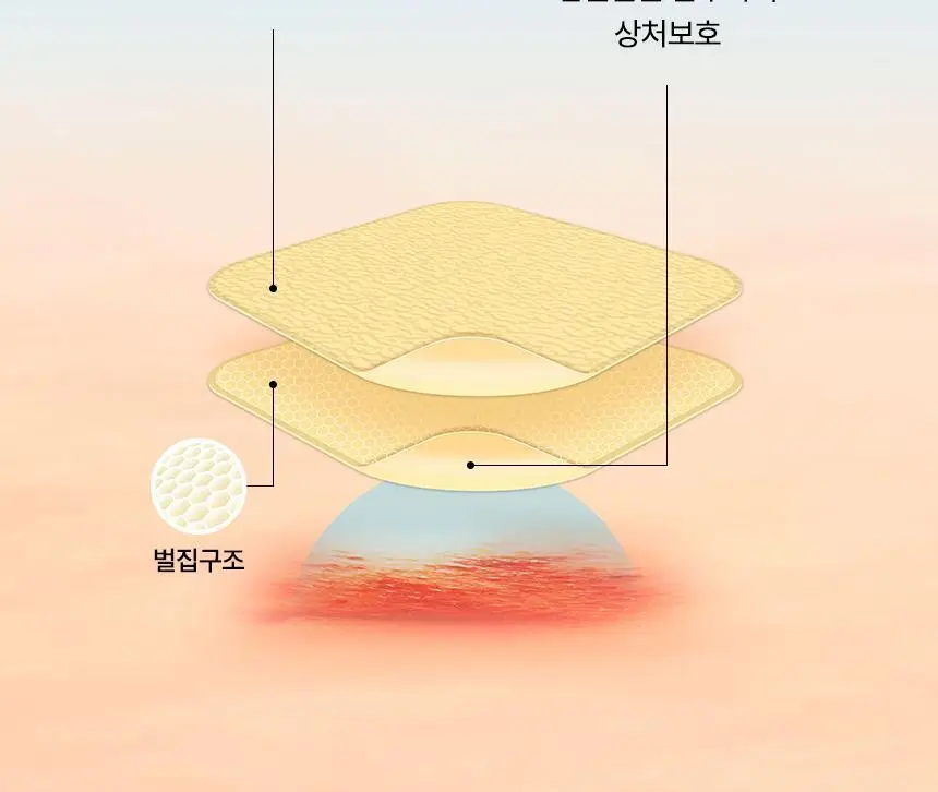[의료기기]듀오덤 엑스트라씬 3매 상세페이지 8
